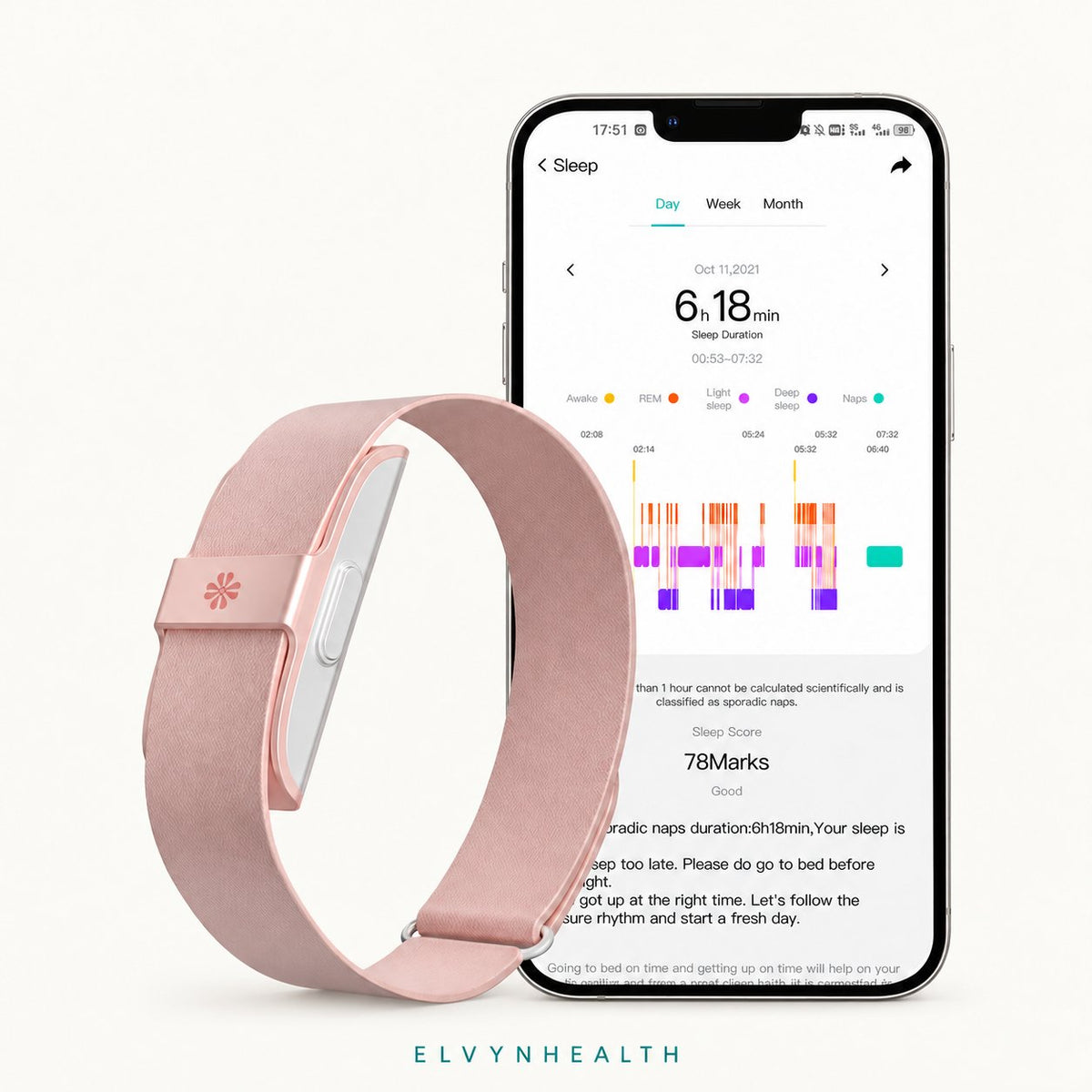 ELVYNHEALTH bracelet